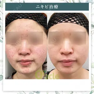 オラクル美容皮膚科 名古屋院の症例