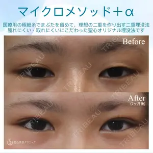 症例