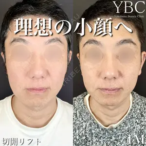 YBC横浜美容外科 大宮院 磯村 亮輔医師の症例