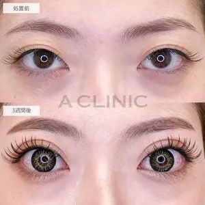 A CLINIC（エークリニック） 大阪院 木家 佑理子医師の症例