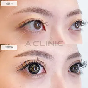 A CLINIC（エークリニック） 大阪院 木家 佑理子医師の症例