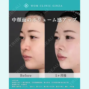 WOM CLINIC GINZA （ワム クリニック ギンザ） 中井 孝昌医師の症例