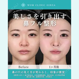 WOM CLINIC GINZA （ワム クリニック ギンザ） 中井 孝昌医師の症例