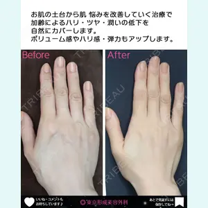 東京形成美容外科 銀座院 中尾 真紀医師の症例