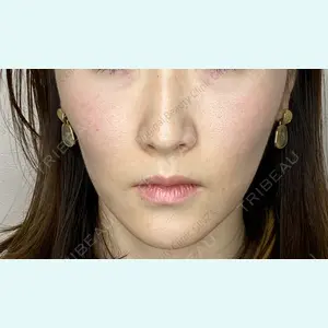 Original Beauty Clinic GINZA 佐藤玲史医師の症例