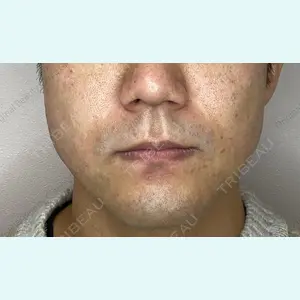 Original Beauty Clinic GINZA 佐藤玲史医師の症例