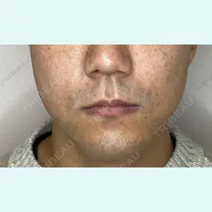 Original Beauty Clinic GINZA 佐藤玲史医師の症例