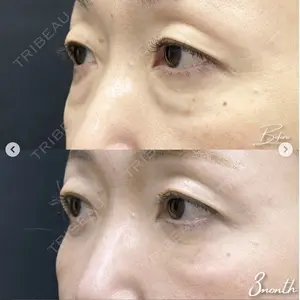 湘南美容クリニック 浜松院の症例