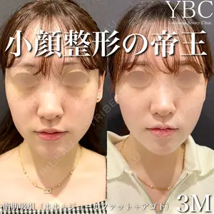 YBC横浜美容外科 大宮院 磯村 亮輔医師の症例