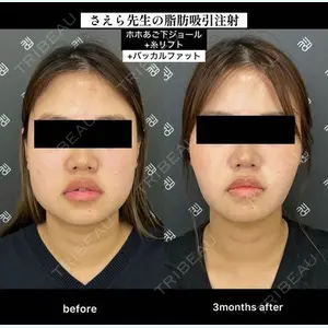 EMMO FACE CLINIC 大阪梅田院 山﨑 冴羅医師の症例