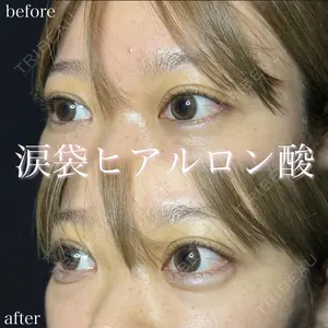 症例