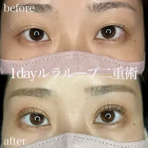 症例
