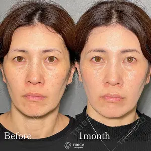 PRISM Beauty Clinic 畑山 知輝医師の症例