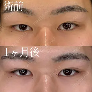 HAAB×DREAM BEAUTY CLINIC 大阪梅田院 柏木 太雅医師の症例