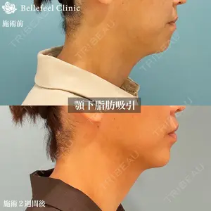 Bellefeel Clinic 新宿 中務 秀一医師の症例