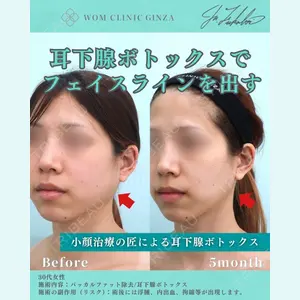 WOM CLINIC GINZA （ワム クリニック ギンザ） 深堀 純也医師の症例