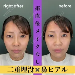 BIANCA銀座 池田 雪太郎医師の症例
