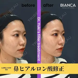 BIANCA銀座 池田 雪太郎医師の症例
