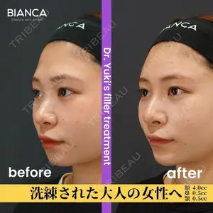 BIANCA銀座 池田 雪太郎医師の症例