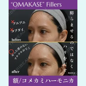BIANCA銀座 池田 雪太郎医師の症例