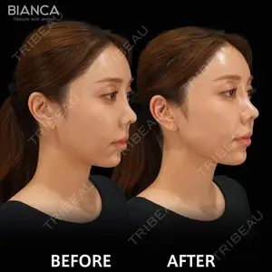 BIANCA銀座 池田 雪太郎医師の症例