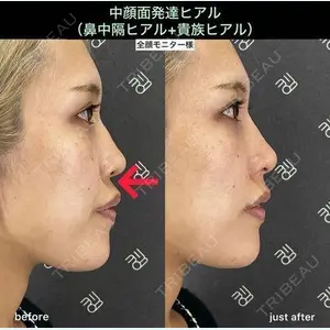 EMMO FACE CLINIC 大阪梅田院 山﨑 冴羅医師の症例