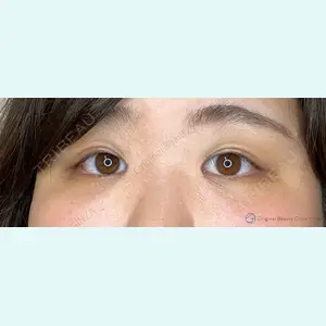 Original Beauty Clinic GINZA 佐藤玲史医師の症例