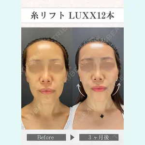 さくらビューティークリニック銀座の症例