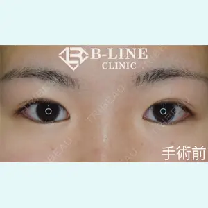 B-LINE CLINIC 池袋院 小池 康弘医師の症例