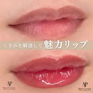 APスキンクリニック銀座 越原あすか｜アートメイク医師の症例