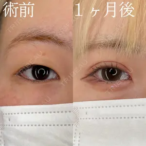 HAAB×DREAM BEAUTY CLINIC 大阪梅田院 柏木 太雅医師の症例