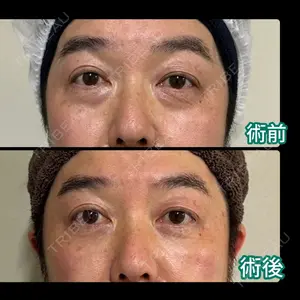症例