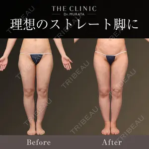 THE CLINIC（ザ・クリニック）東京院 村田 八千穂医師の症例