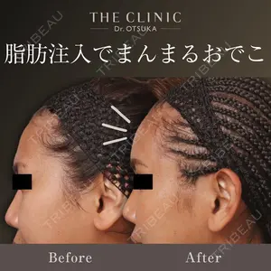 THE CLINIC（ザ・クリニック）東京院 大塚 憲医師の症例