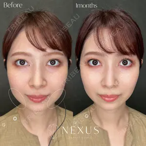 NEXUS CLINICの症例