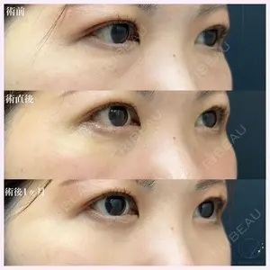 AI Beauty Clinic （エーアイ美容クリニック） 田中 里佳医師の症例