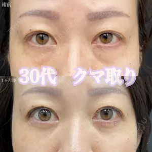 AI Beauty Clinic （エーアイ美容クリニック） 田中 里佳医師の症例