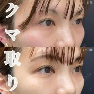 AI Beauty Clinic （エーアイ美容クリニック） 田中 里佳医師の症例