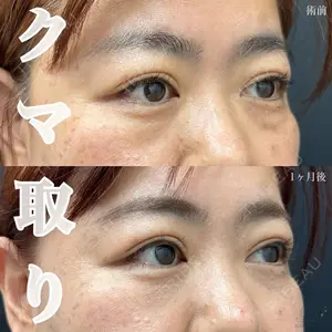 AI Beauty Clinic （エーアイ美容クリニック） 田中 里佳医師の症例