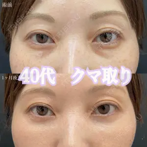 症例