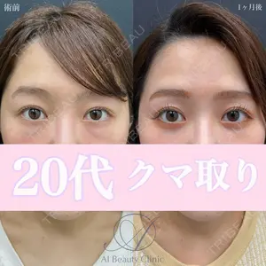 症例