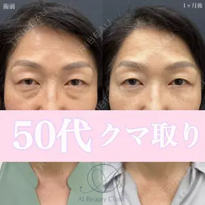 症例