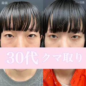症例