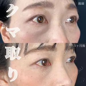 症例