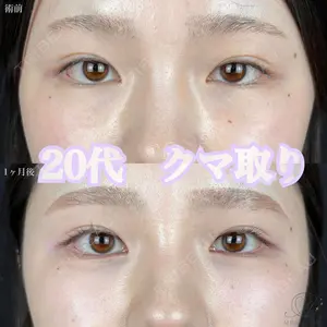 症例