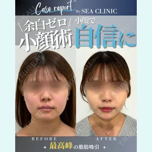 SEA CLINIC（シークリニック） 沼澤 茂医師の症例