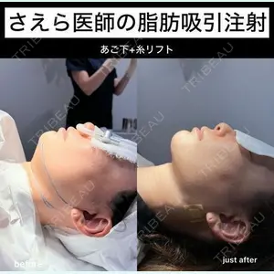 EMMO FACE CLINIC 大阪梅田院 山﨑 冴羅医師の症例