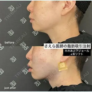 EMMO FACE CLINIC 大阪梅田院 山﨑 冴羅医師の症例