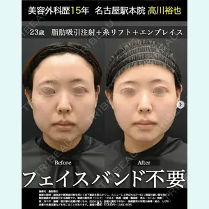 湘南美容クリニック 名古屋駅本院 高川 裕也医師の症例