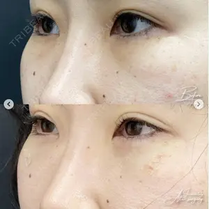 湘南美容クリニック 浜松院の症例